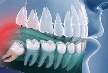 +nxBvIAAAAAXRSTlMAQObYZgAAABZJREFUOI1jYMADmEe5o9xR7iiXQi4A4BsA388WUyMAAAAASUVORK5CYII=